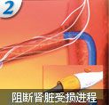 阜新无痛人流多少钱